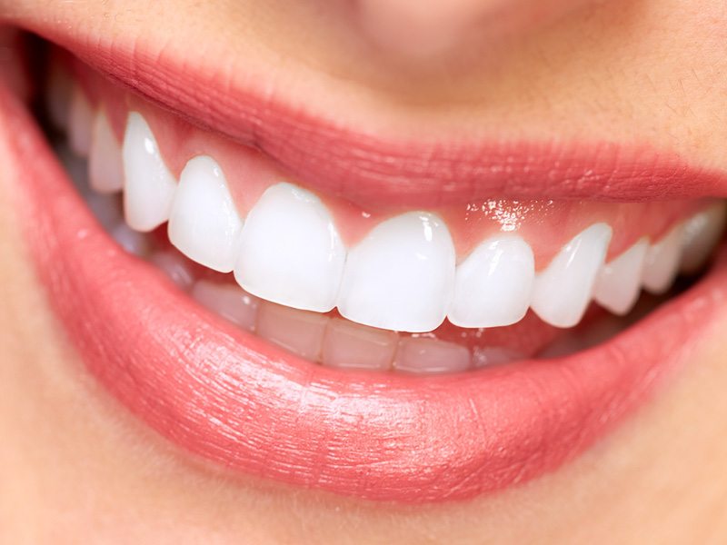 Closeup of Women's White Smile