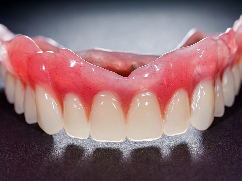 Closeup of Partial Dentures