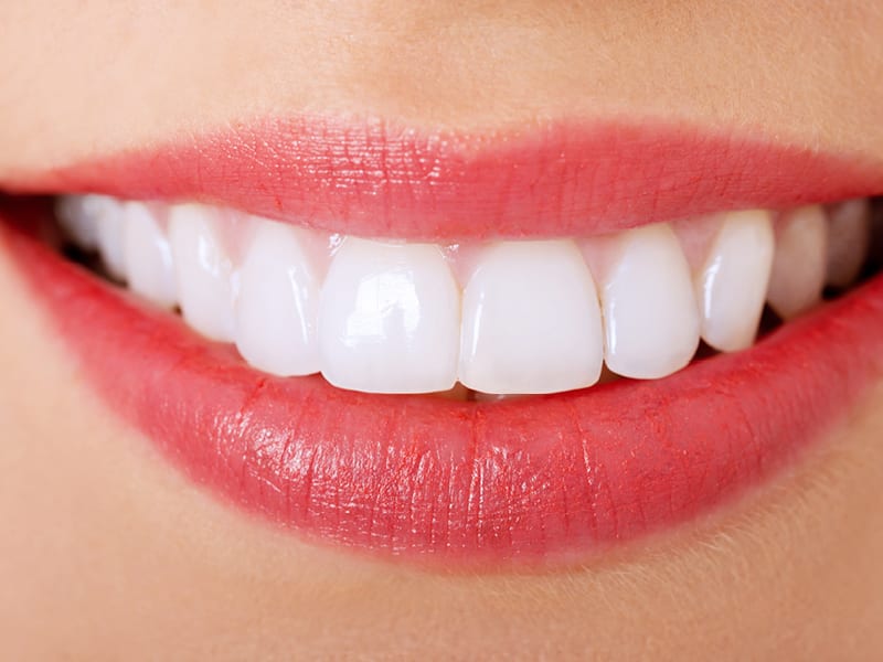 Woman Smiling with White Teeth