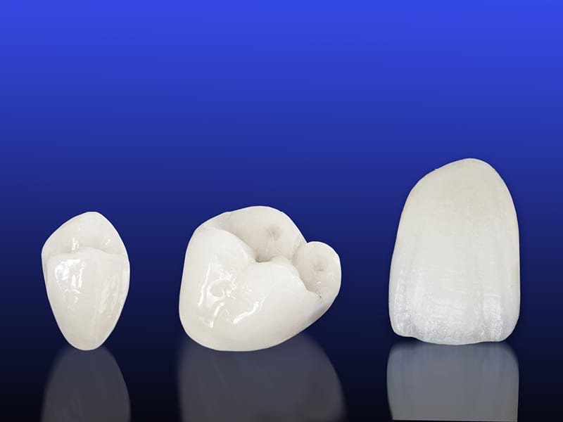 Examples of Three White Teeth