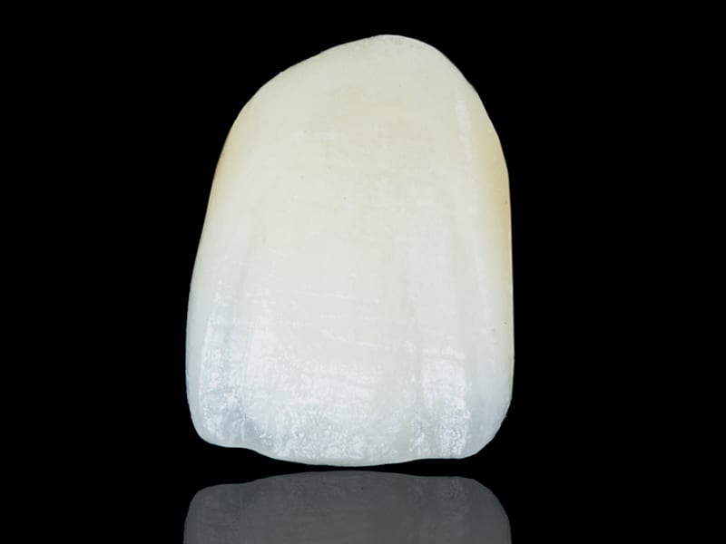 Example of One White Tooth