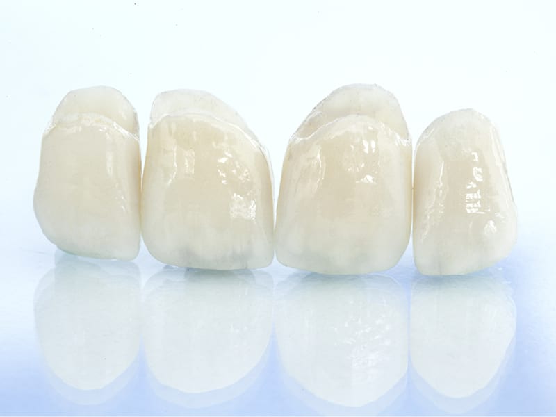 Image of Four White Teeth